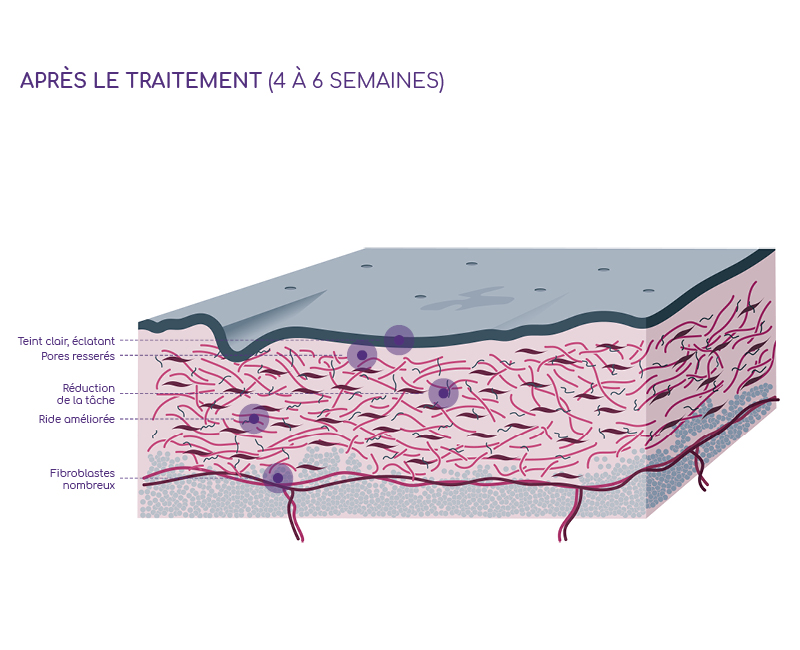 Image illustrative