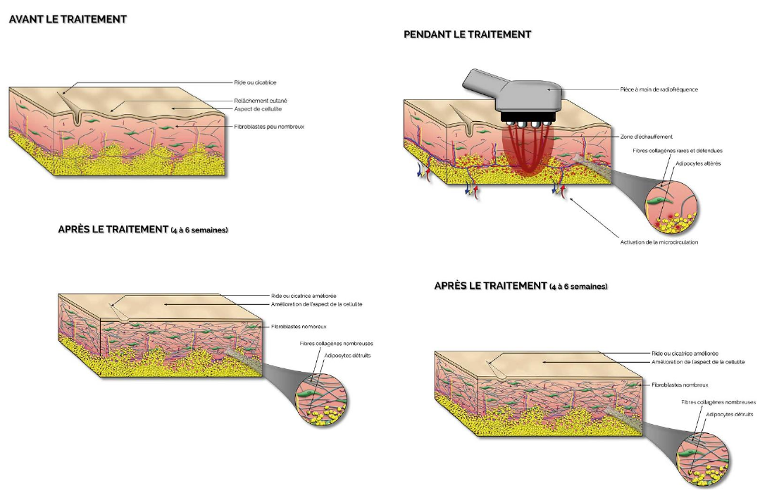 Image illustrative