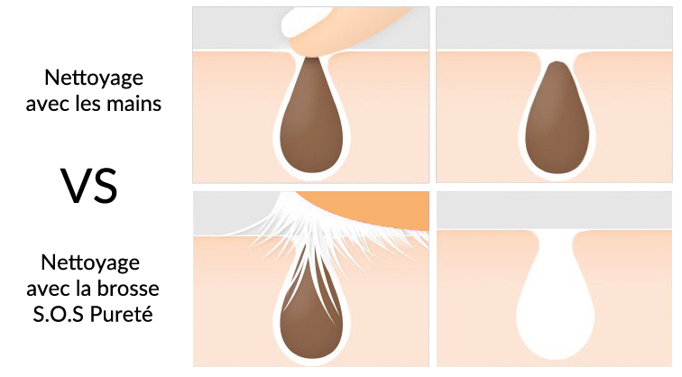Image illustrative